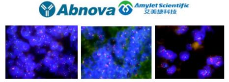 Abnova丨艾美捷ACTN4 DNA 探针解决方案 Abnova丨艾美捷ACTN4 DNA 探针解决方案