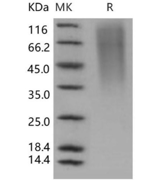 Assay Genie重组人CD164/Endolyn蛋白(His标签)(RPES3015)