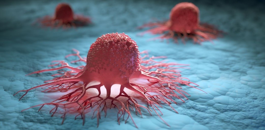 【分享】德国Nordmark助力TILs细胞疗法从肿瘤组织中提取TILs的GMP级胶原酶方案_曼博生物