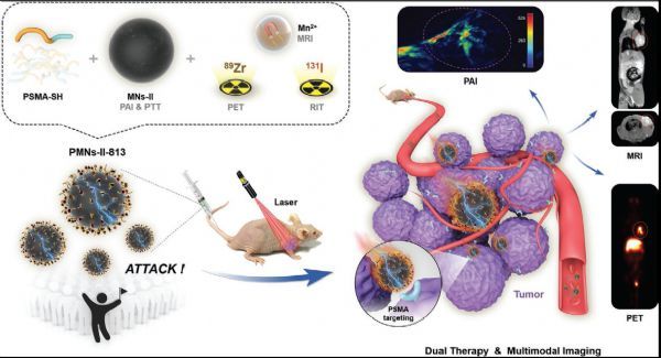 研究以PET/CT为代表性的新技术的出现为疾病诊疗提供全新视野