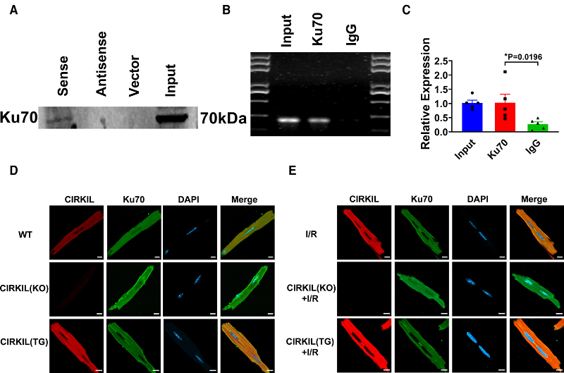 哈尔滨医科大学潘振伟团队发现治疗心脏缺血/再灌注损伤的新靶点
