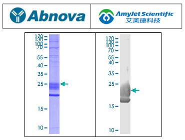 说明书丨Abnova艾美捷 EDA(人)重组蛋白 说明书丨Abnova艾美捷 EDA(人)重组蛋白