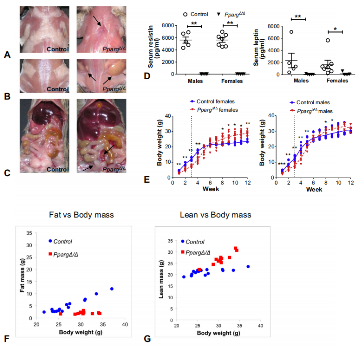 先天性全身性脂肪萎缩症