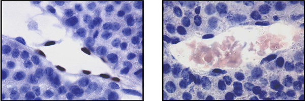 CalBioreagents ID蛋白单克隆抗体相关介绍及结果鉴赏 CalBioreagents ID蛋白单克隆抗体相关介绍及结果鉴赏