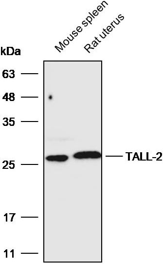 抗体产品星推荐第十一期|Anti-TALL-2 Polyclonal Antibody