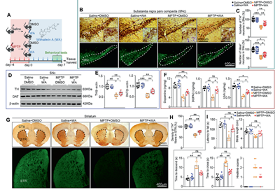醉茄素A通过DJ1-Nrf2-STING轴在帕金森病中发挥神经保护作用