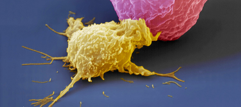 免疫细胞专题 | NK细胞