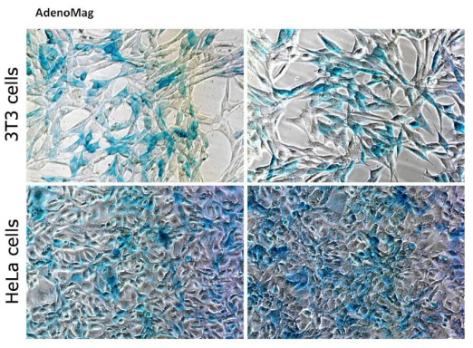 艾美捷AdenoMag转染试剂,高效,无需修饰病毒 艾美捷AdenoMag转染试剂,高效,无需修饰病毒