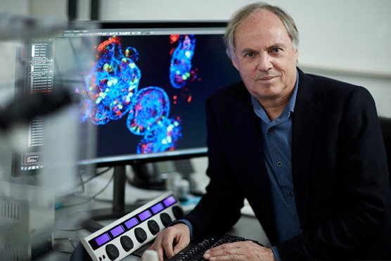 小爱手把手教学—3D 类器官培养及研究思路