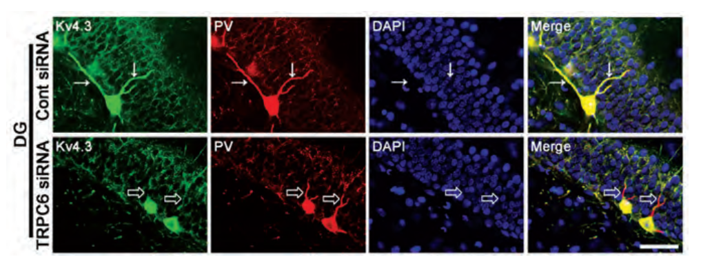 衰老与离子通道：钾离子通道KV4在衰老过程中连接认知功能下降和心功能障碍