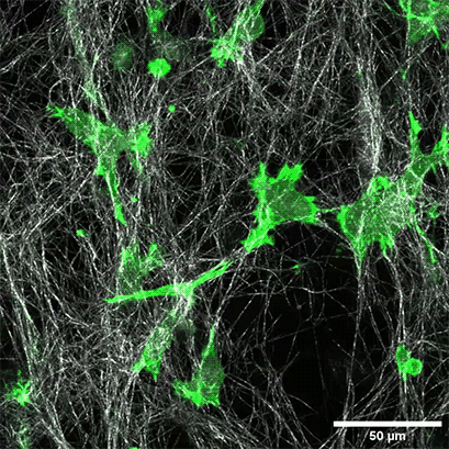 3D细胞培养|和ibidi一起拓展细胞培养维度