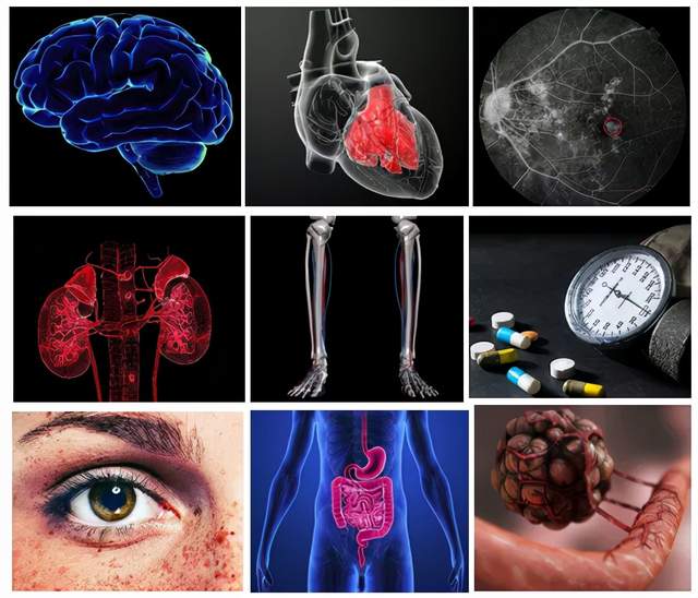 一文速览激光散斑血流成像系统11个热门应用场景，不断拓展微循环研究