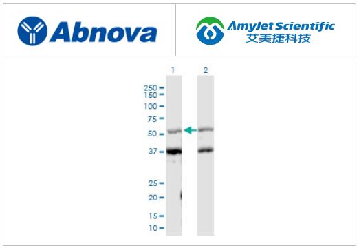 Abnova神经生物学研究：EFNB2 DNAxPab
