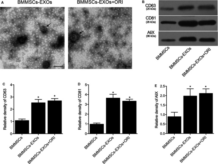 来自冬凌草素预处理的MSC的外泌体通过自噬激活抑制细胞凋亡减轻心肌缺血/再灌注损伤
