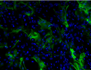Jackson丨艾美捷代理Cy3 AffiniPure驴抗兔IgG(H+L)多克隆抗体价格触底，限时抢购！