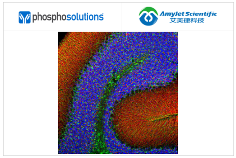 艾美捷Phosphosolutions抗α突触核蛋白抗体(2A7)方案 艾美捷Phosphosolutions抗α突触核蛋白抗体(2A7)方案