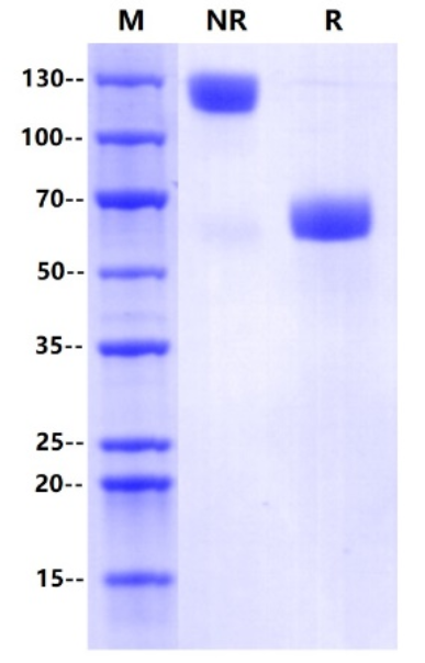 Absin重组蛋白上新啦！ PD-1,PD-L1助力抗肿瘤免疫治疗！