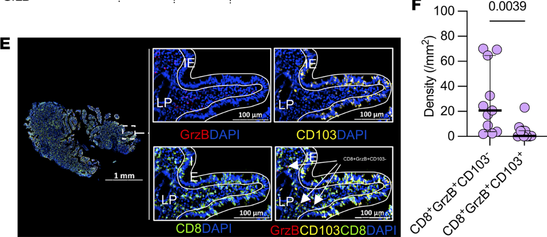 CD8+T细胞的有限毒性潜能在抗HIV感染中的差异化定位分布