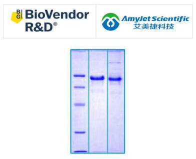BioVendor艾美捷Cadherin-1 人 HEK293说明书 BioVendor艾美捷Cadherin-1 人 HEK293说明书