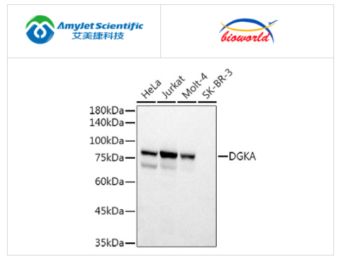 DGK-α多克隆抗体丨艾美捷Bioworld解决方案
