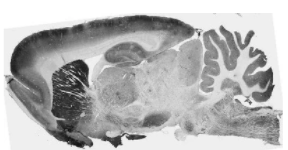 NeuroMab-PTEN诱导的抗Pink1假定激酶1抗体(N4/15)促销啦 NeuroMab-PTEN诱导的抗Pink1假定激酶1抗体(N4/15)促销啦