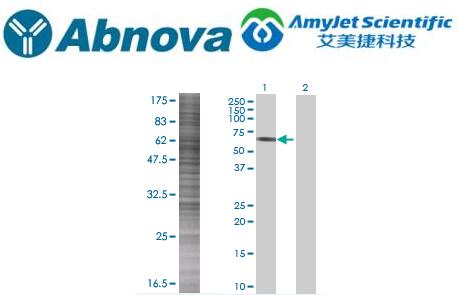 Abnova ABI2 293T 细胞瞬时过表达裂解物说明书 Abnova ABI2 293T 细胞瞬时过表达裂解物说明书
