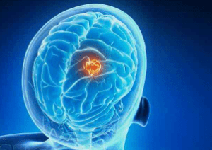 实验室生长的杀伤细胞可以治疗脑肿瘤 