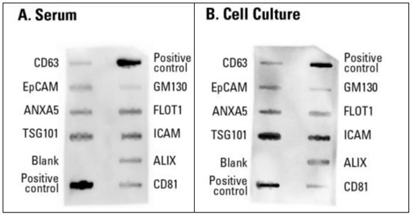 SBI代理-Exo-Check外泌体抗体芯片-促销价不容错过