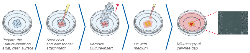 ibidi划痕实验/细胞迁移|不同实验方法及对比？