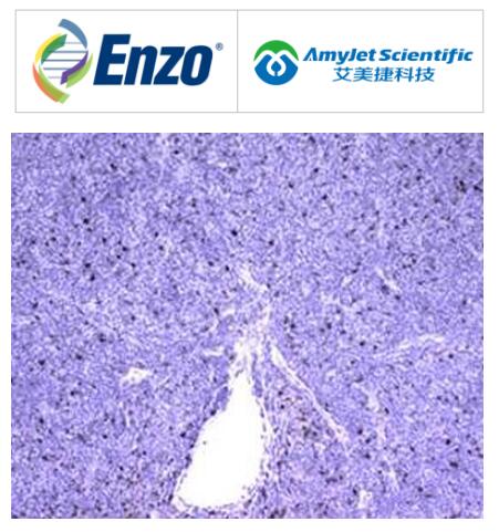 Enzo Life Sciences丨艾美捷LAG-3（人）重组单克隆抗体