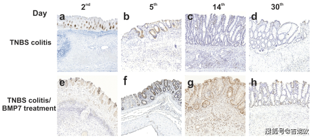 TNBS/DNBS 诱导结肠炎模型成本低、发病快，在炎症性肠病（IBD）各个方面研究中发挥着关键作用