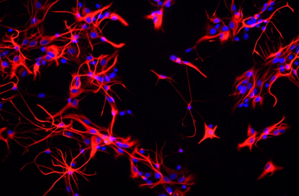 星形胶质细胞标志物