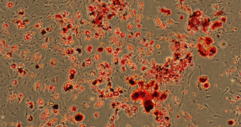 细胞养久了就污染是什么情况