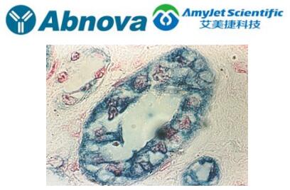 Abnova RealBlue 过氧化物酶底物试剂盒（附文献参考）
