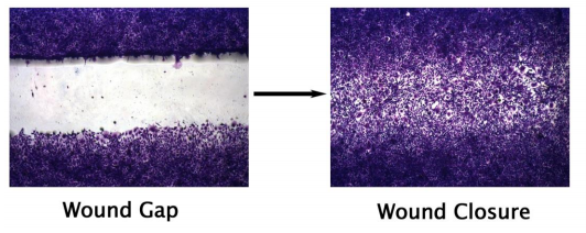 艾美捷 24孔细胞划痕试验试剂盒参数说明和相关研究 艾美捷 24孔细胞划痕试验试剂盒参数说明和相关研究