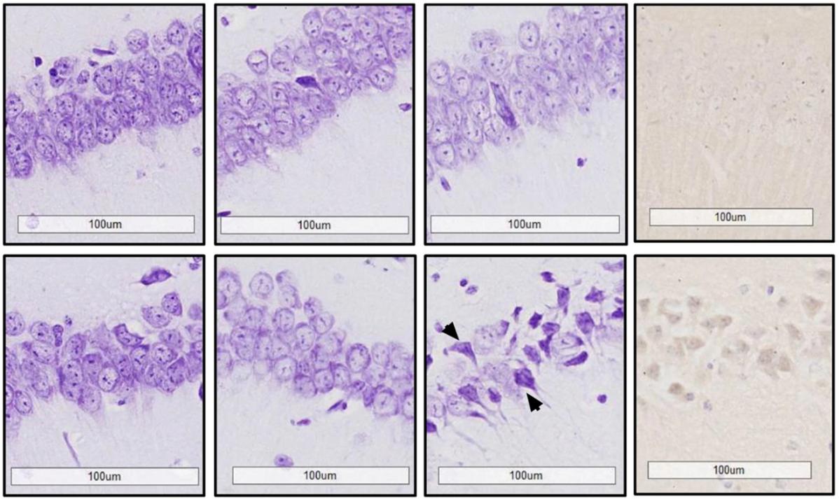 超越斑块：淀粉样前体蛋白如何影响 GABA 能传递