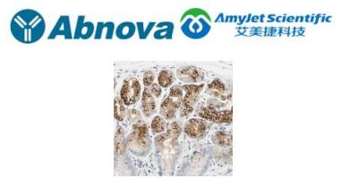 Abnova丨A4GNT多克隆抗体中英文说明 Abnova丨A4GNT多克隆抗体中英文说明