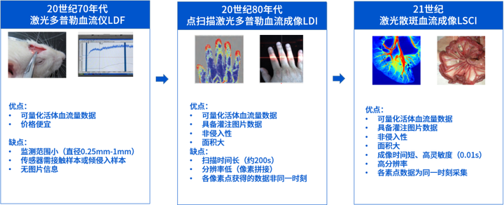 详解微循环血流仪变迁史，提前剧透新一代激光散斑血流成像为何更强大