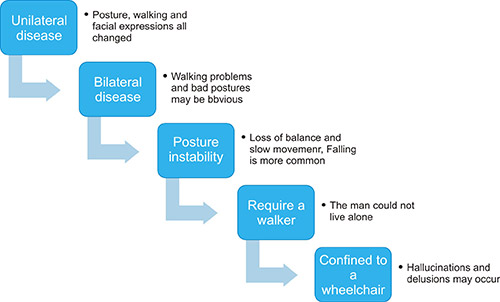 帕金森病的五个阶段
