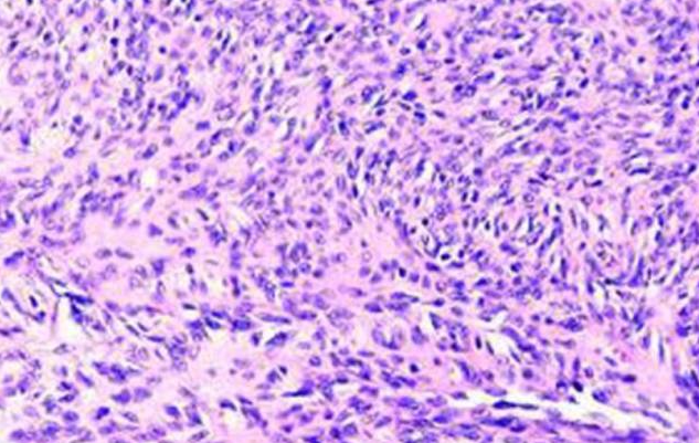 干货分享 | 5分钟掌握免疫组化实验