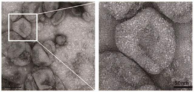 前沿文献解读 | 当小胶质细胞、MicroRNA与胶质瘢痕一起出现，会有什么样的神奇发现？