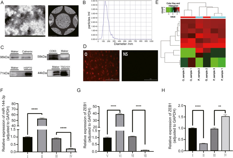 外泌体鉴定 外泌体鉴定
