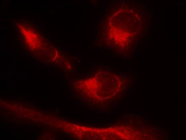 产品资料：兔抗MAPT (Phospho-Ser356)多克隆抗体