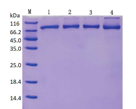 逆转录酶核心原料的选择——M-MLV逆转录酶