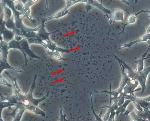 黑胶虫污染后的细胞图片