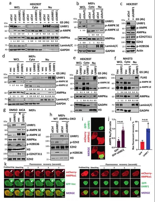 UHRF1调控糖脂代谢