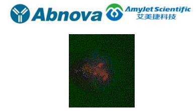 Abnova丨5-甲基胞嘧啶多克隆抗体中英文说明 Abnova丨5-甲基胞嘧啶多克隆抗体中英文说明