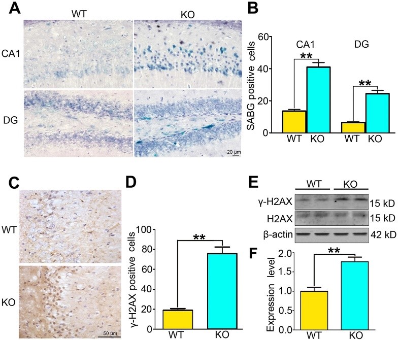 中枢神经系统衰老的十种研究思路