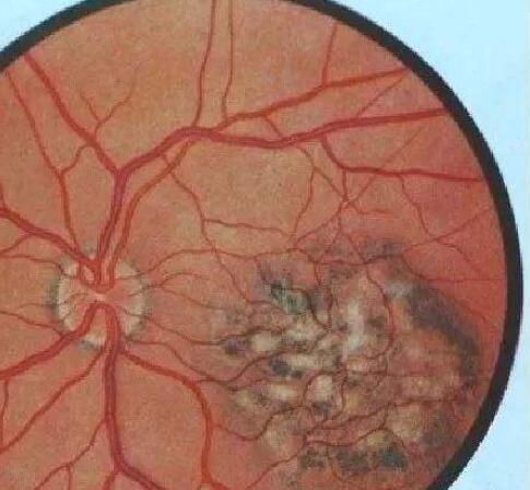 CAR-T细胞与可注射凝胶中包装的增强免疫力药物相结合的治疗方法