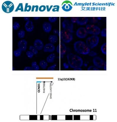 Abnova 基因 FISH 探针丨CCND1(橙色)FISH 探针 Abnova 基因 FISH 探针丨CCND1(橙色)FISH 探针